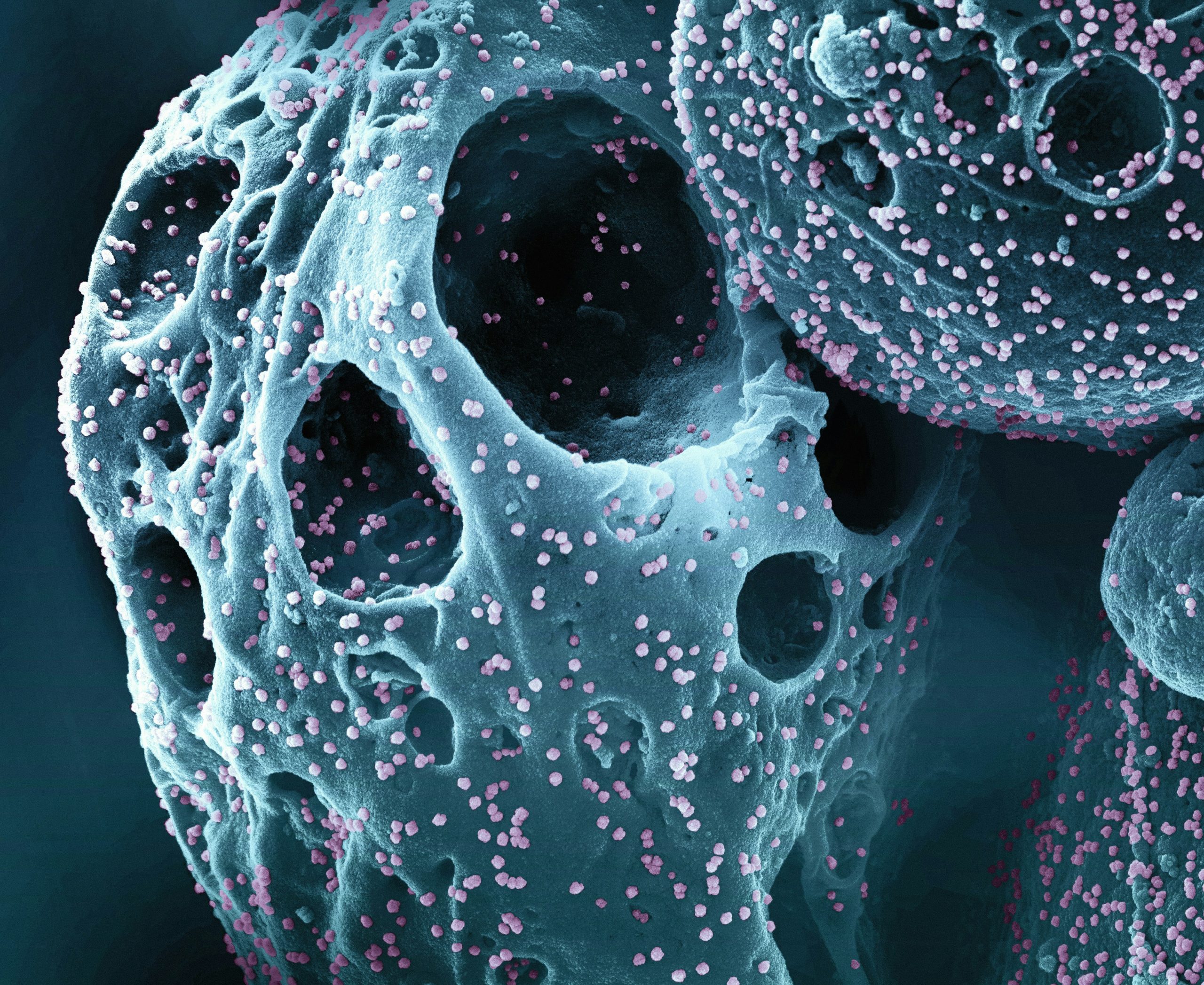 national institute of allergy and infectious diseases 1zlvac7hwt8 unsplash